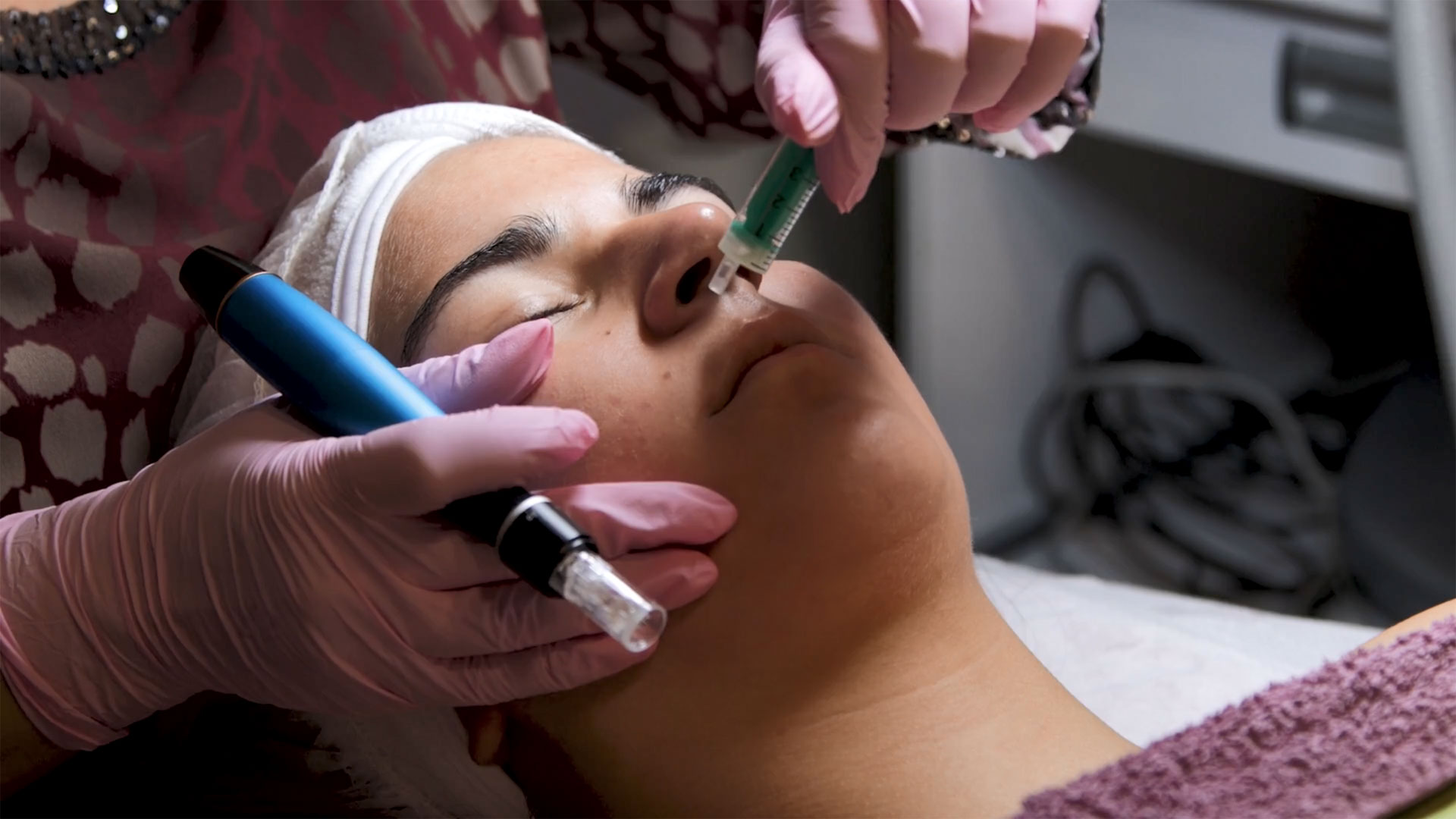 Microneedling treatment (Dermapen treatment) — изображение 5