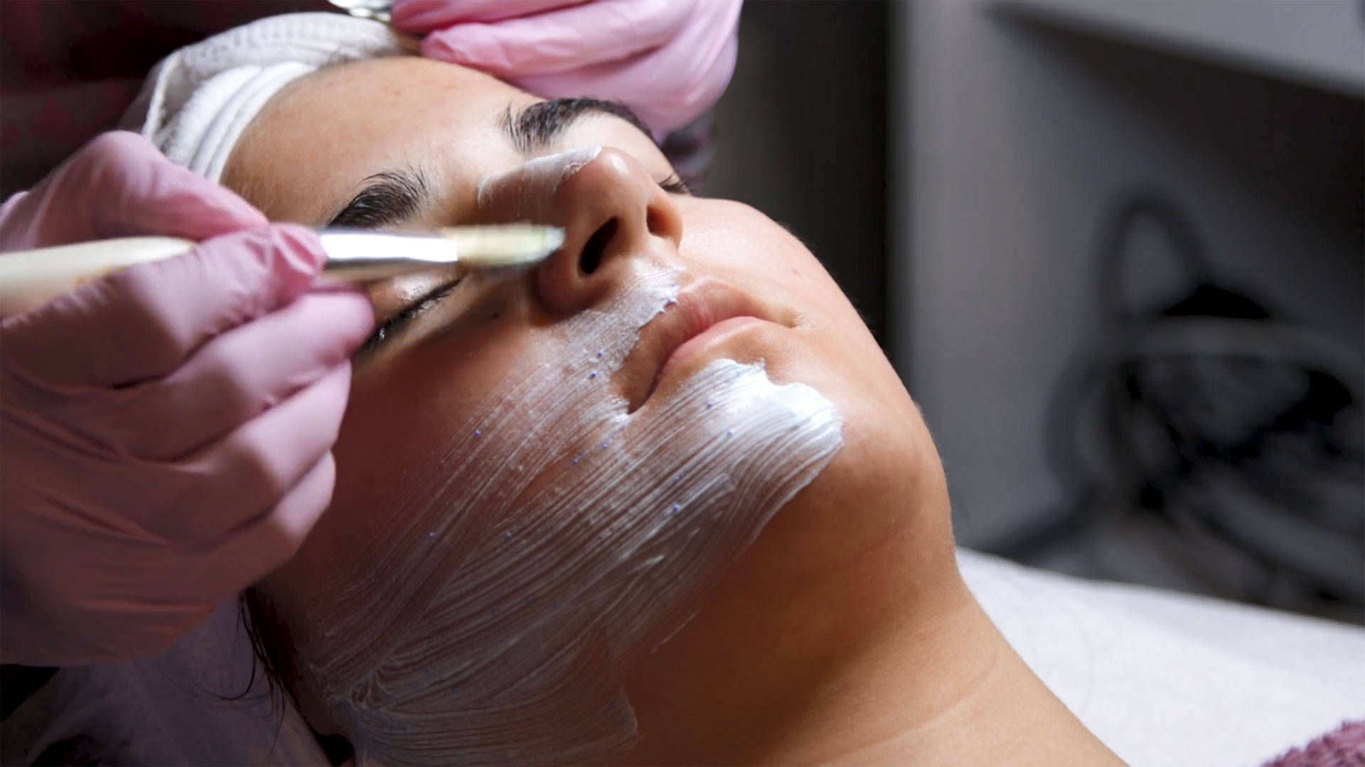 Microneedling treatment (Dermapen treatment) — изображение 7